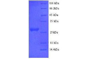 IL-6 (AA 27-241), (full length) protein (His tag)