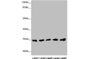 Western blot All lanes: EEF1B2 antibody at 0. (EEF1B2 anticorps  (AA 1-225))