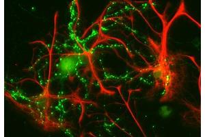 Indirect immunofluorescence labeling of cultured rat astrocytes and hippocampus neurons with anti-GFAP (red; dilution 1 : 1000) and anti-synaptophysin (green; ; dilution 1 : 200).