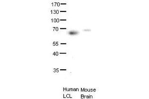 ETS2 antibody - middle region  validated by WB using human LCL and mouse brains at 1:1000. (ETS2 anticorps  (Middle Region))