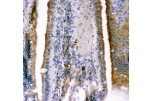 Anti- KCNMA1antibody,IHC(P) IHC(P): Mouse Intestine Tissue (KCNMA1 anticorps  (AA 124-467))