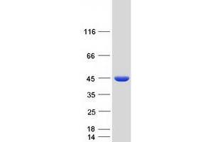 Validation with Western Blot