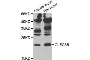 Western blot analysis of extracts of various cell lines, using CLEC3B antibody (ABIN5973819) at 1/1000 dilution. (CLEC3B anticorps)