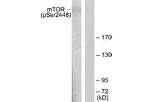 Western blot analysis of extracts from HeLa cells treated with EGF 200ng/ml 30', using mTOR (Phospho-Ser2448) Antibody. (MTOR anticorps  (pSer2448))