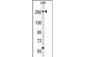 Western blot analysis in uterus tumor cell line lysates (35ug/lane). (WNK3 anticorps  (C-Term))
