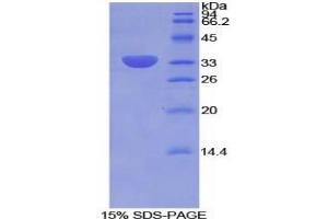 SDS-PAGE analysis of Rat Integrin beta 2 Protein. (Integrin beta 2 Protein (ITGB2))