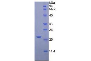 SDS-PAGE analysis of Human CD8b Protein.