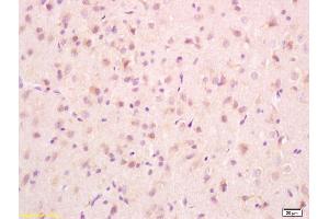 Formalin-fixed and paraffin embedded rat brain tissue labeled with Anti-PCMT1 Polyclonal Antibody, Unconjugated (ABIN715796) at 1:200, followed by conjugation to the secondary antibody and DAB staining (PCMT1 anticorps  (AA 165-227))