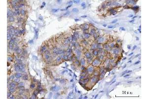 IHC analysis of gamma Catenin using anti-gamma Catenin antibody (ABIN7602031). (JUP anticorps  (AA 556-745))
