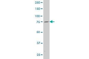 ABCA6 polyclonal antibody (A01), Lot # 060707JCS1 Western Blot analysis of ABCA6 expression in HeLa .