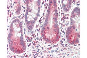Anti-LRRK1 antibody IHC staining of human small intestine. (LRRK1 anticorps  (AA 474-523))