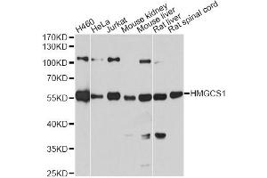 Western blot analysis of extracts of various cell lines, using HMGCS1 antibody (ABIN5972092) at 1:7000 dilution. (HMGCS1 anticorps)