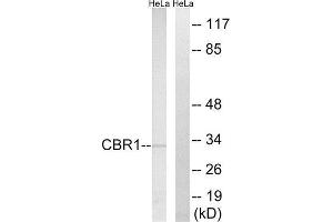 Western Blotting (WB) image for anti-Carbonyl Reductase 1 (CBR1) (Internal Region) antibody (ABIN1851014) (CBR1 anticorps  (Internal Region))