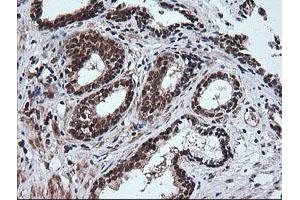 Image no. 6 for anti-Rhotekin (RTKN) antibody (ABIN1500702) (Rhotekin anticorps)