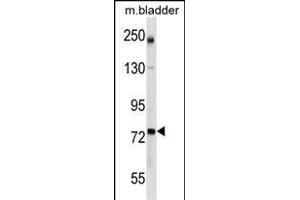 GCLC Antibody (Center) (ABIN1538246 and ABIN2849959) western blot analysis in mouse bladder tissue lysates (35 μg/lane). (GCLC anticorps  (AA 286-315))