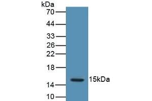 Detection of Recombinant LHb, Human using Polyclonal Antibody to Luteinizing Hormone Beta Polypeptide (LHb) (LHB anticorps  (AA 23-141))