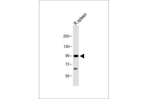 Cbl Proto-Oncogene B, E3 Ubiquitin Protein Ligase (CBLB) (AA 103-130) anticorps