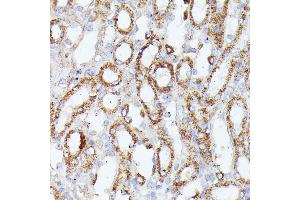 Immunohistochemistry of paraffin-embedded mouse kidney using CDK5R antibody (ABIN7266235) at dilution of 1:100 (40x lens). (CDK5RAP1 anticorps  (AA 1-350))