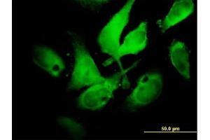 Immunofluorescence of  purified  MaxPab antibody to NCF2 on HeLa cell.