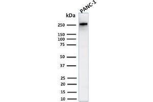 Western Blot Analysis of Human PANC-1 cell lysate using Spectrin beta III Rabbit Recombinant Monoclonal (SPTBN2/2894R). (Recombinant Spectrin, Beta, Non-erythrocytic 2 (SPTBN2) (AA 356-475) anticorps)