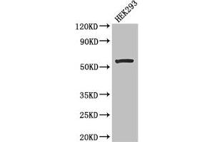 Western Blot Positive WB detected in: HEK293 whole cell lysate All lanes: MLYCD antibody at 2. (MLYCD anticorps  (AA 40-493))