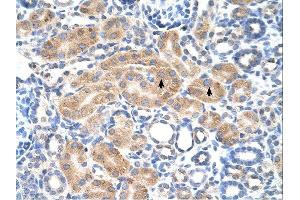 PDE9A antibody was used for immunohistochemistry at a concentration of 4-8 ug/ml. (PDE9A anticorps  (N-Term))