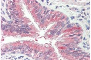 Human Lung, Respiratory Epithelium: Formalin-Fixed, Paraffin-Embedded (FFPE)