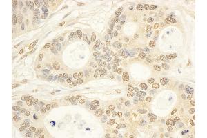 anti-Cytokine Induced Apoptosis Inhibitor 1 (CIAPIN1) (AA 262-312) antibody