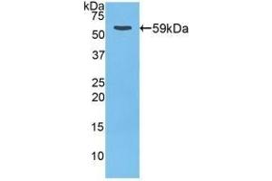 Detection of Recombinant CTSD, Rat using Polyclonal Antibody to Cathepsin D (CTSD) (Cathepsin D anticorps  (AA 120-407))