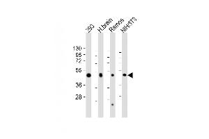 Western Blot at 1:2000 dilution Lane 1: 293 whole cell lysate Lane 2: human brain lysate Lane 3: Ramos whole cell lysate Lane 4: NIH/3T3 whole cell lysate Lysates/proteins at 20 ug per lane.