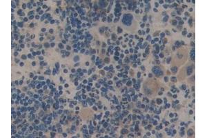 Detection of TRAF2 in Mouse Spleen Tissue using Polyclonal Antibody to TNF Receptor Associated Factor 2 (TRAF2)