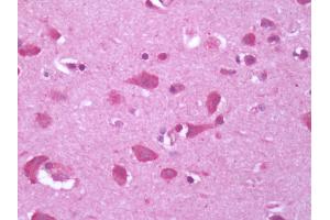 Human Brain, Cortex: Formalin-Fixed, Paraffin-Embedded (FFPE) (GPR34 anticorps)
