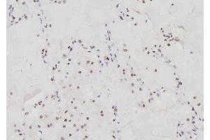 ABIN6276303 at 1/100 staining Human lung tissue by IHC-P. (DDIT3 anticorps  (N-Term))