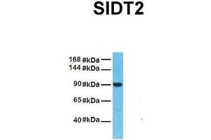 Host:  Rabbit  Target Name:  SIDT2  Sample Tissue:  Human Fetal Liver  Antibody Dilution:  1. (SIDT2 anticorps  (N-Term))