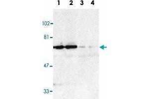 Western blot analysis of TNFRSF21 in K-562 (1, 3) and Raji (2, 4) whole cell lysate in the absence (1, 2) or presence (3, 4) of blocking peptide with TNFRSF21 polyclonal antibody  at 1 : 500 dilution. (TNFRSF21 anticorps  (AA 42-56))