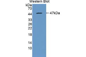 Western blot analysis of the recombinant protein. (MTTP anticorps  (AA 28-459))