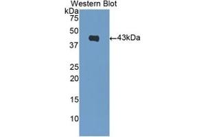 Detection of Recombinant BNP, Human using Polyclonal Antibody to Brain Natriuretic Peptide (BNP) (BNP anticorps  (AA 27-121))