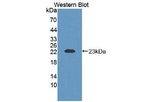 Western blot analysis of the recombinant protein. (ECT2 anticorps  (AA 453-647))