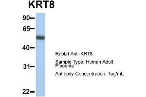Host:  Rabbit  Target Name:  KRT8  Sample Type:  Human Adult Placenta  Antibody Dilution:  1. (KRT8 anticorps  (Middle Region))