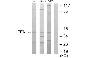 Immunohistochemistry analysis of paraffin-embedded human breast carcinoma tissue using FEN1 antibody. (FEN1 anticorps)