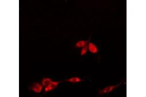 ABIN6275756 staining  HuvEC cells by IF/ICC. (SLC30A9 anticorps  (Internal Region))