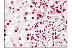Human Kidney: Formalin-Fixed, Paraffin-Embedded (FFPE)