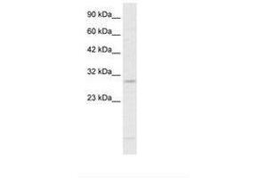 Image no. 2 for anti-RNA-binding protein Raly (RALY) (N-Term) antibody (ABIN6735882) (Raly anticorps  (N-Term))