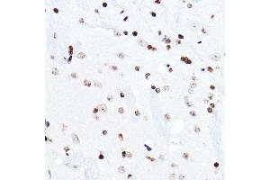 Immunohistochemistry of paraffin-embedded mouse brain using ELF5 Rabbit pAb (ABIN6130882, ABIN6140130, ABIN6140131 and ABIN6222999) at dilution of 1:50 (40x lens).