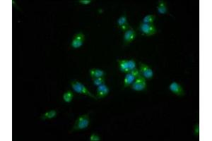 Immunofluorescence staining of SH-SY5Y cells with ABIN7167554 at 1:166, counter-stained with DAPI. (REG3A anticorps  (AA 27-175))