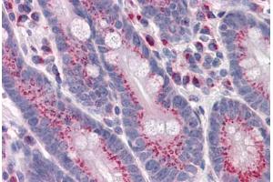 Human Small intestine: Formalin-Fixed, Paraffin-Embedded (FFPE) (GPR3 anticorps  (AA 1-331))