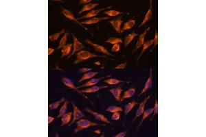 anti-Nucleoredoxin (NXN) (AA 100-280) antibody