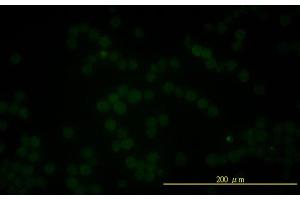 Immunofluorescence of monoclonal antibody to FOLH1 on K-562 cell . (PSMA anticorps  (AA 1-719))