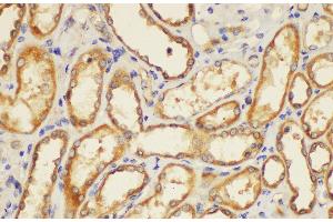 Immunohistochemistry of paraffin-embedded Human kidney using ST14 Ployclonal Antibody at dilution of 1:200. (ST14 anticorps)