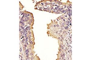 (ABIN388979 and ABIN2850435) staining SQSTM1 in Human prostate tissue sections by Immunohistochemistry (IHC-P - paraformaldehyde-fixed, paraffin-embedded sections). (SQSTM1 anticorps  (AA 317-346))